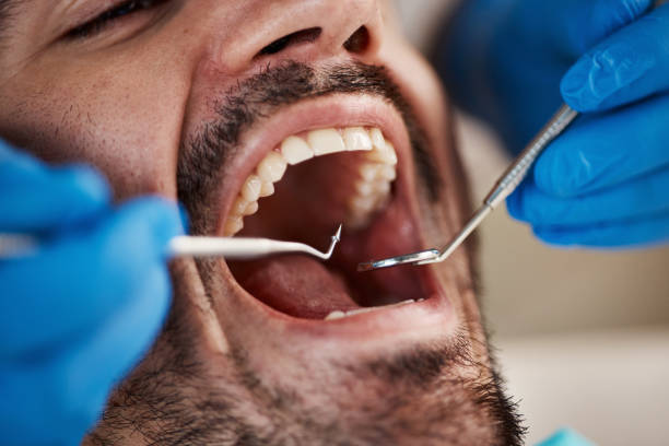 Best Emergency TMJ Treatment in Weedsport, NY