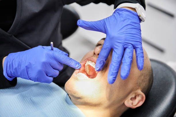 Best Emergency Dental Care for Broken or Chipped Teeth in Weedsport, NY
